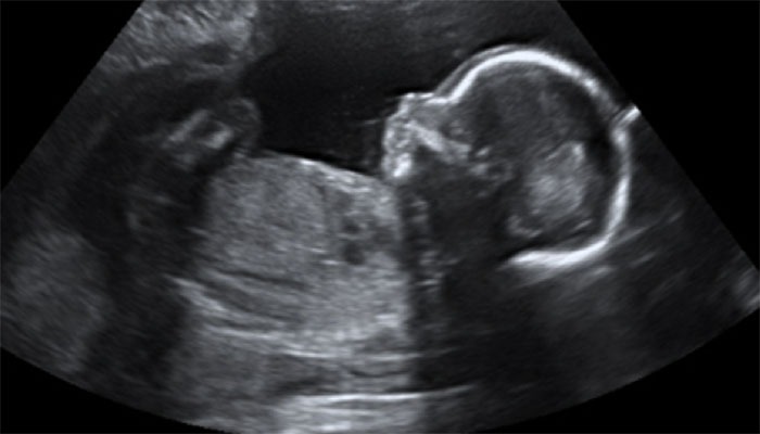 Obstetric Ultrasound Bozeman MT